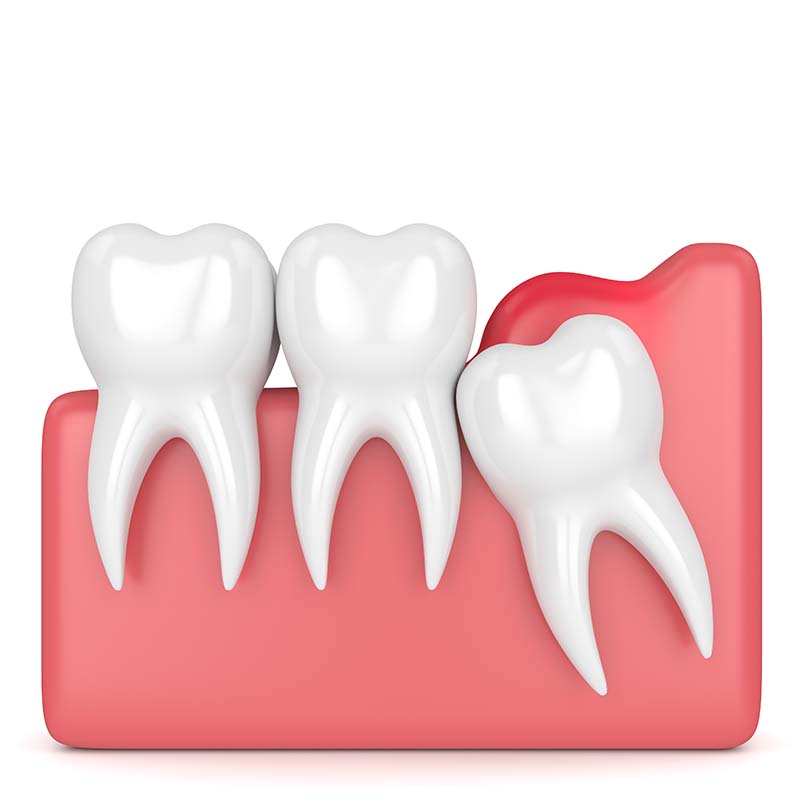 Happy woman with healthy teeth